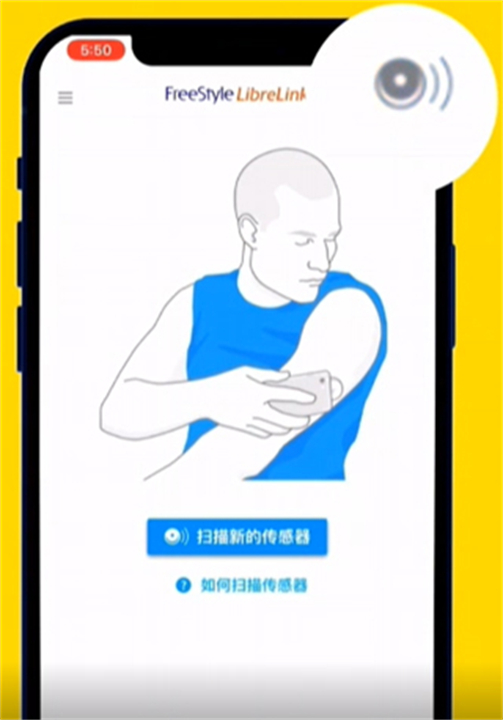 雅培瞬感血糖仪检测